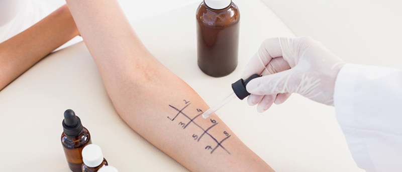 29 Jan 2015 --- Doctor doing skin prick test at her patient --- Image by © Wavebreakmedia LTD/Wavebreak Media Ltd./Corbis