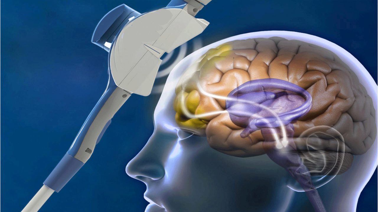 Transcranial Magnetic Stimulation for Autism: Fact or Fiction?