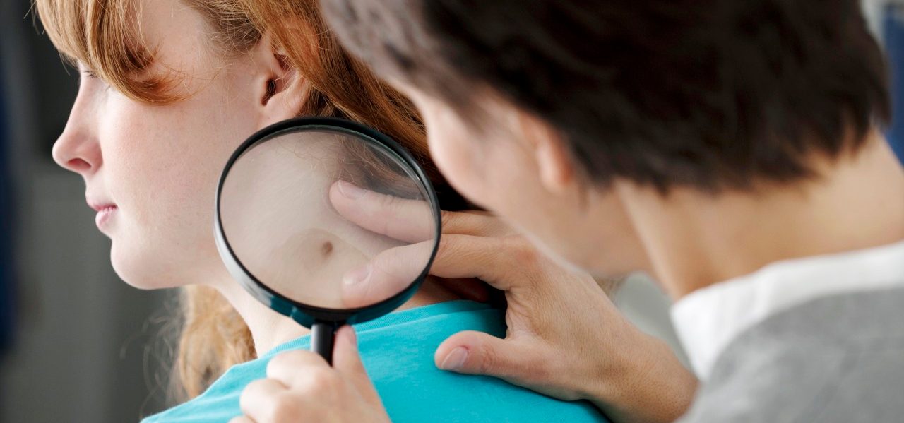 20 Nov 2012 --- Dermatology consultation woman --- Image by © B. Boissonnet/BSIP/Corbis