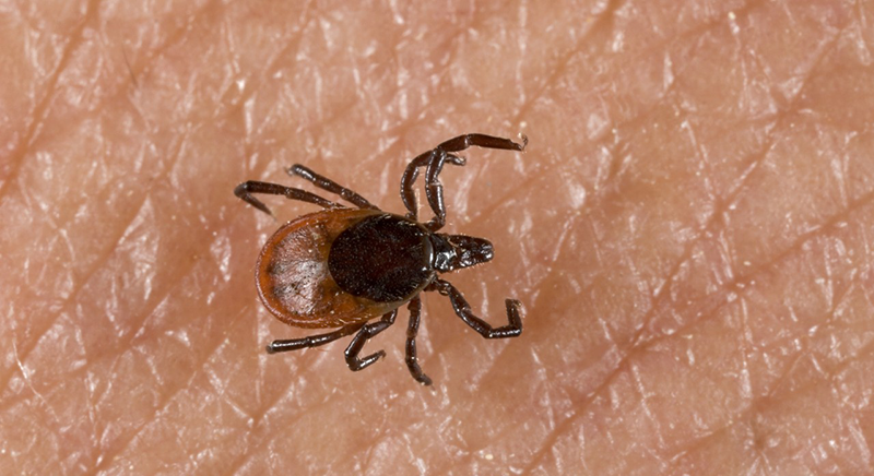 02 Jul 2006 --- Detail shot of a tick on human skin --- Image by © Torbjörn Arvidson/Matton Collection/Corbis