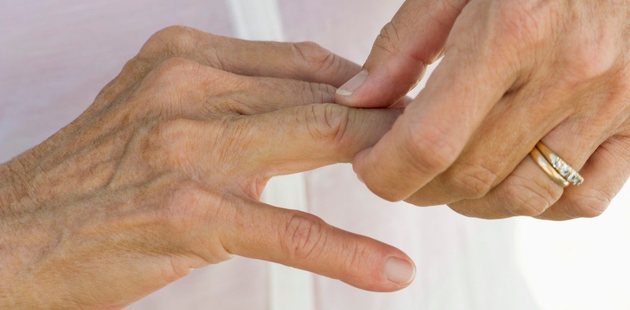 Senior woman rubbing knuckles, cropped --- Image by © Frederic Cirou/PhotoAlto/Corbis