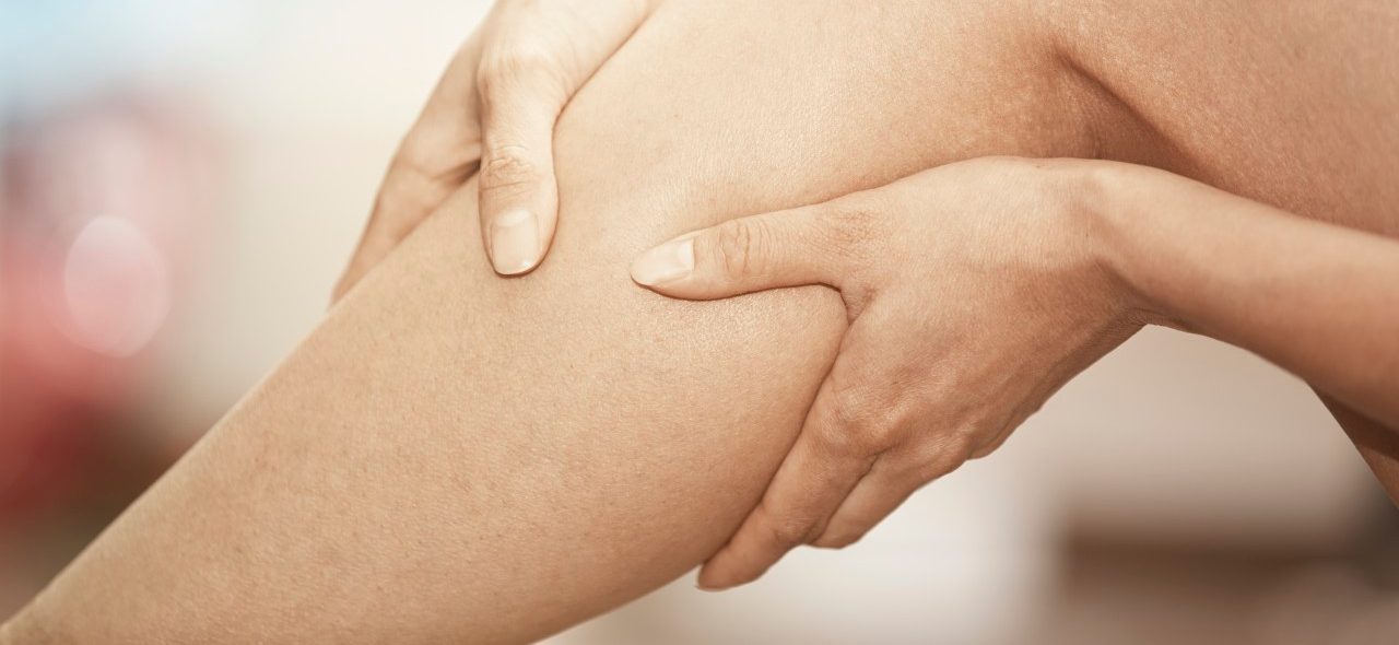 15 Feb 2015 --- Woman gripping her injured leg --- Image by © Arman Zhenikeyev/Corbis