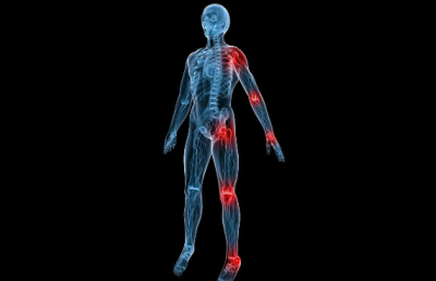 Fibromyalgia Trigger Points