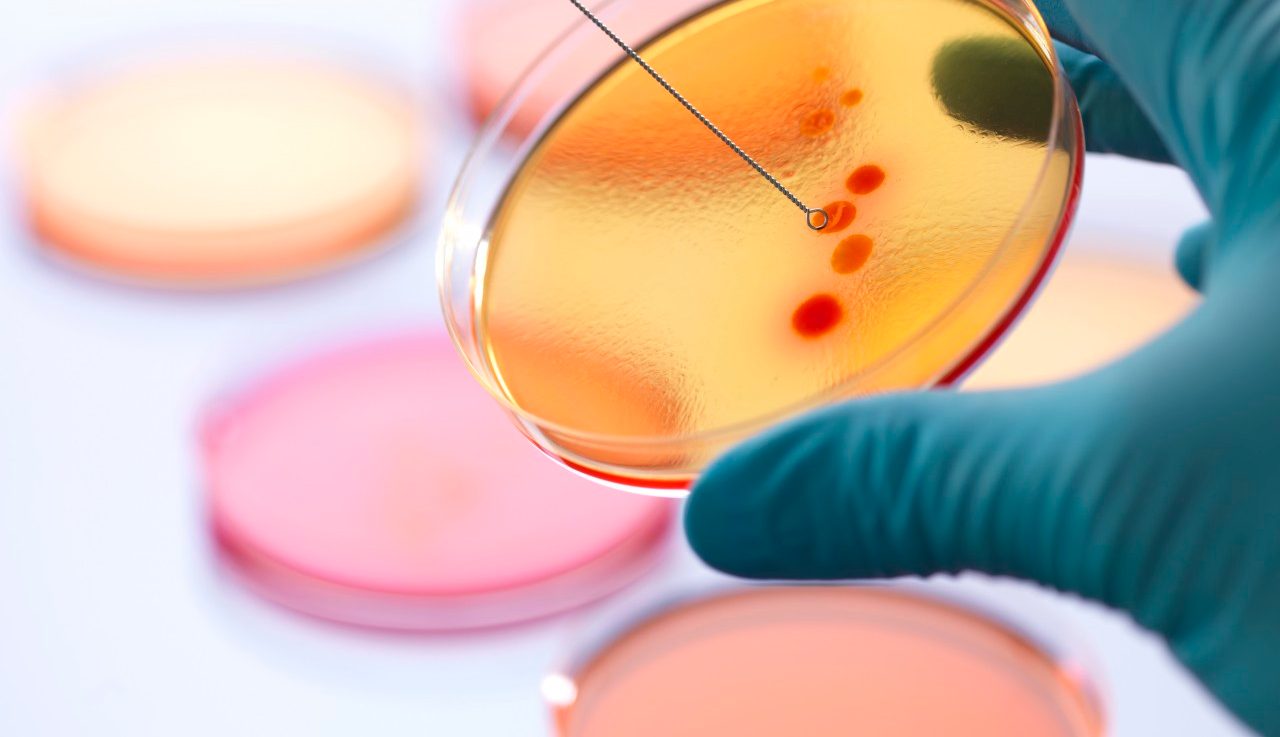 04 Jan 2013 --- Close up of male scientist hand inoculating an agar plates with bacteria in microbiology lab --- Image by © Rafe Swan/Corbis