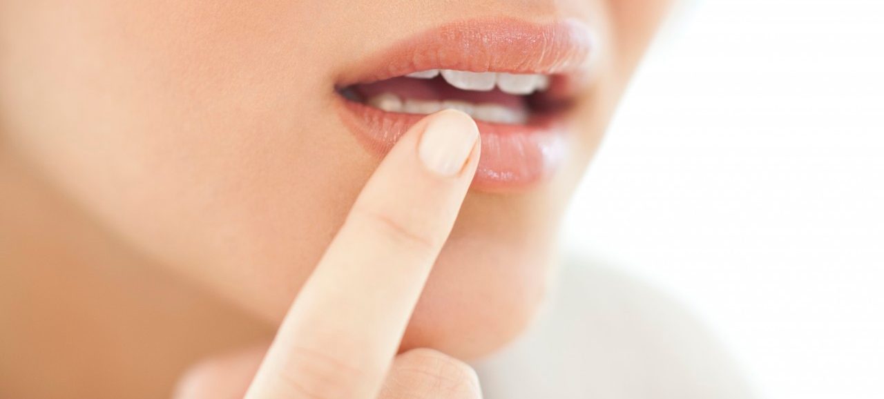 Cold sore, conceptual image. --- Image by © IAN HOOTON/Science Photo Library/Corbis