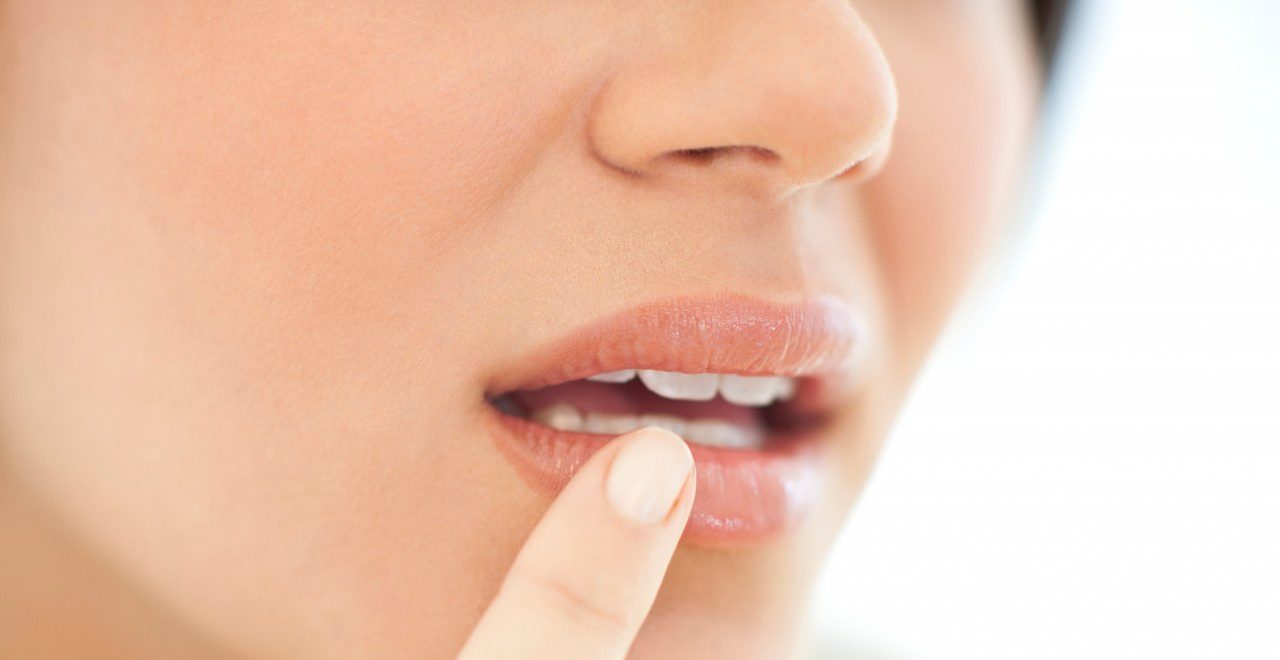 Cold sore, conceptual image. --- Image by © IAN HOOTON/Science Photo Library/Corbis