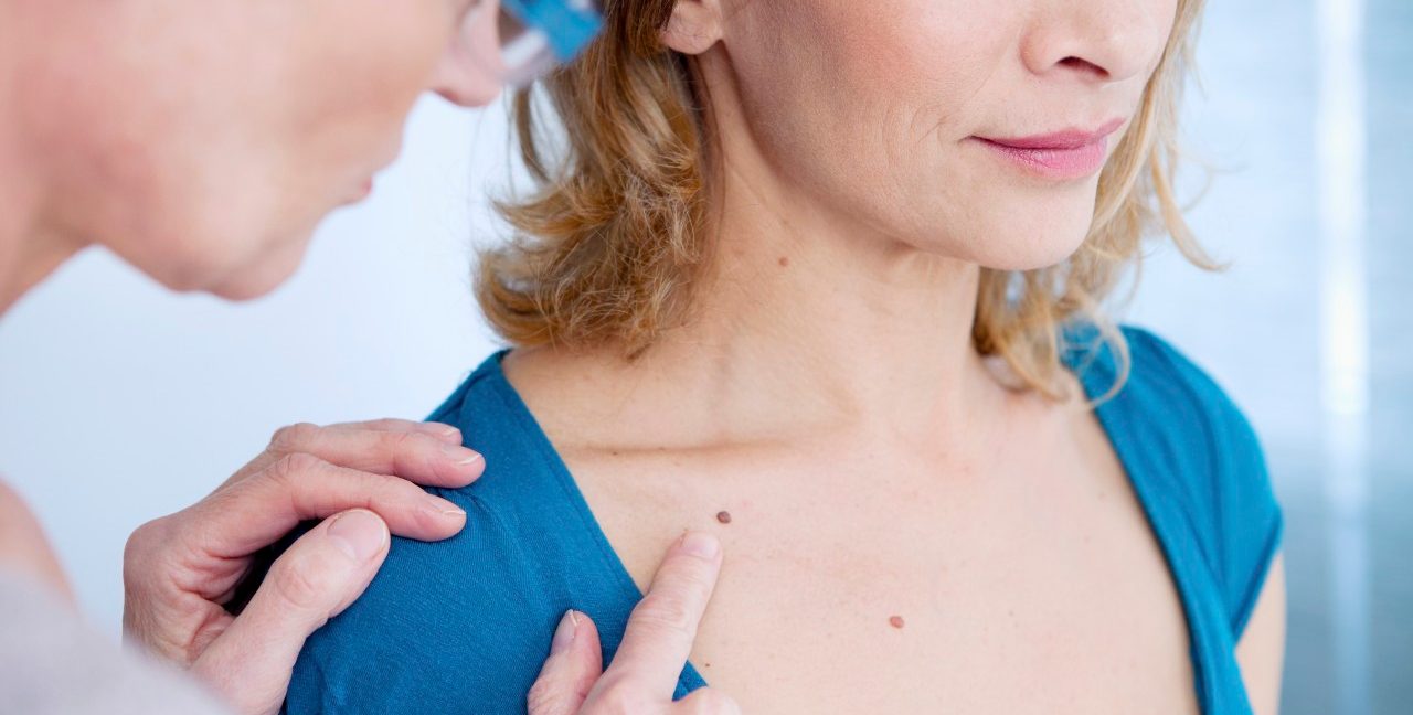 07 Mar 2014 --- Doctor examining the upper chest of a patient. --- Image by © B. BOISSONNET / BSIP/BSIP/Corbis