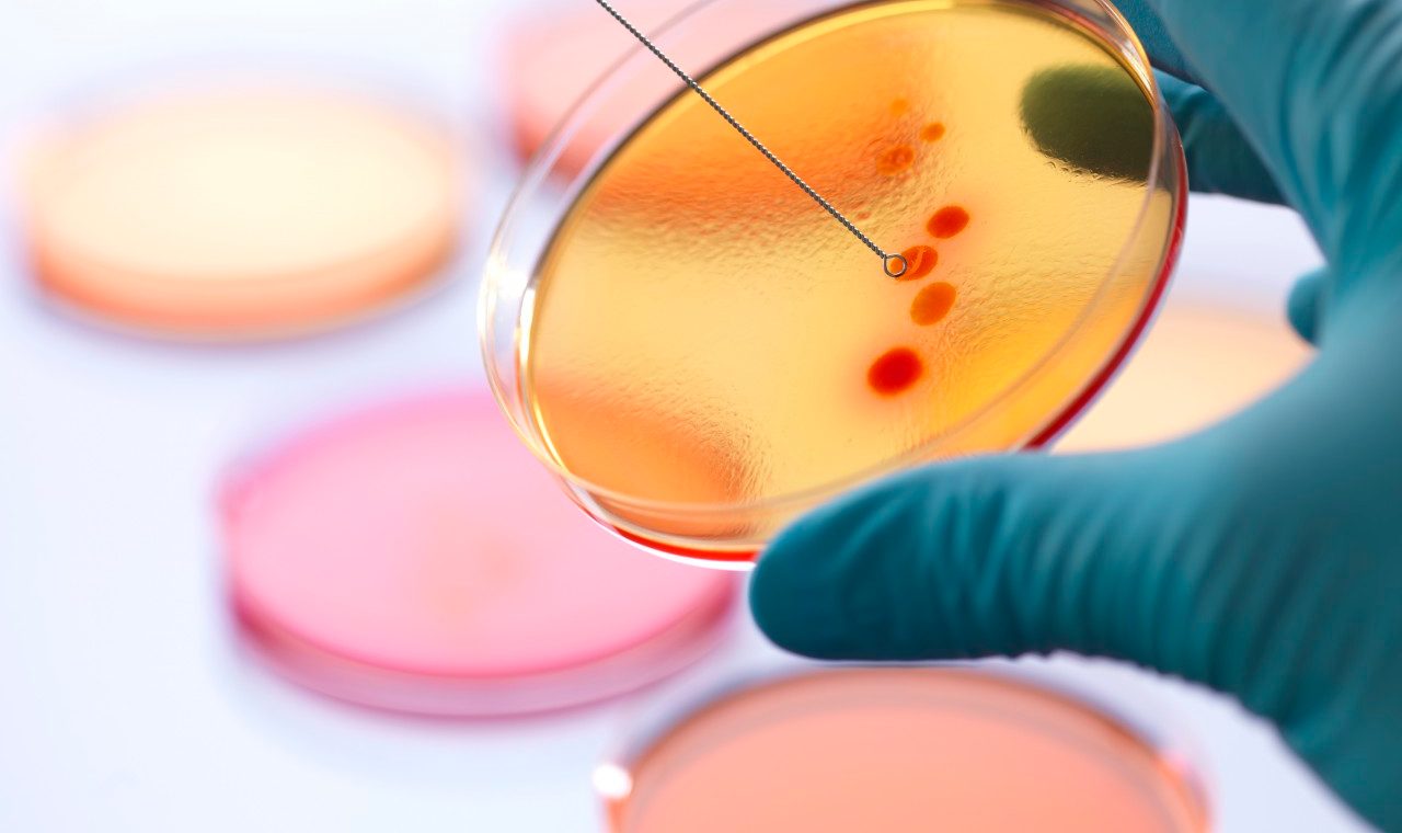 04 Jan 2013 --- Close up of male scientist hand inoculating an agar plates with bacteria in microbiology lab --- Image by © Rafe Swan/Corbis