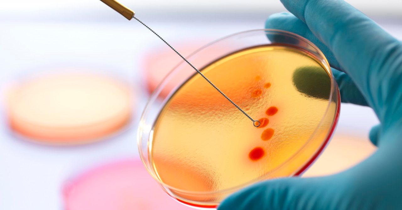 04 Jan 2013 --- Close up of male scientist hand inoculating an agar plates with bacteria in microbiology lab --- Image by © Rafe Swan/Corbis