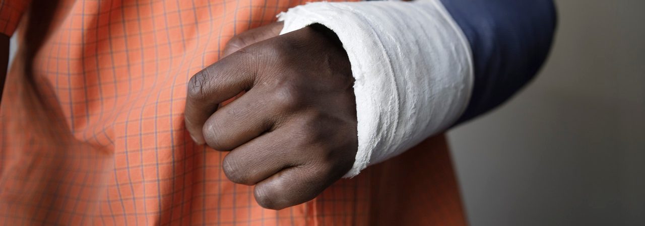 Man with broken arm close-up of cast --- Image by © moodboard/Corbis