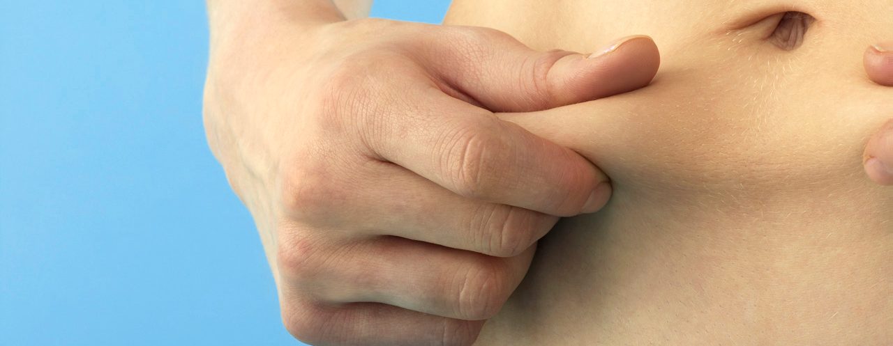 Young Woman Holding Skin on Stomach --- Image by © Corbis