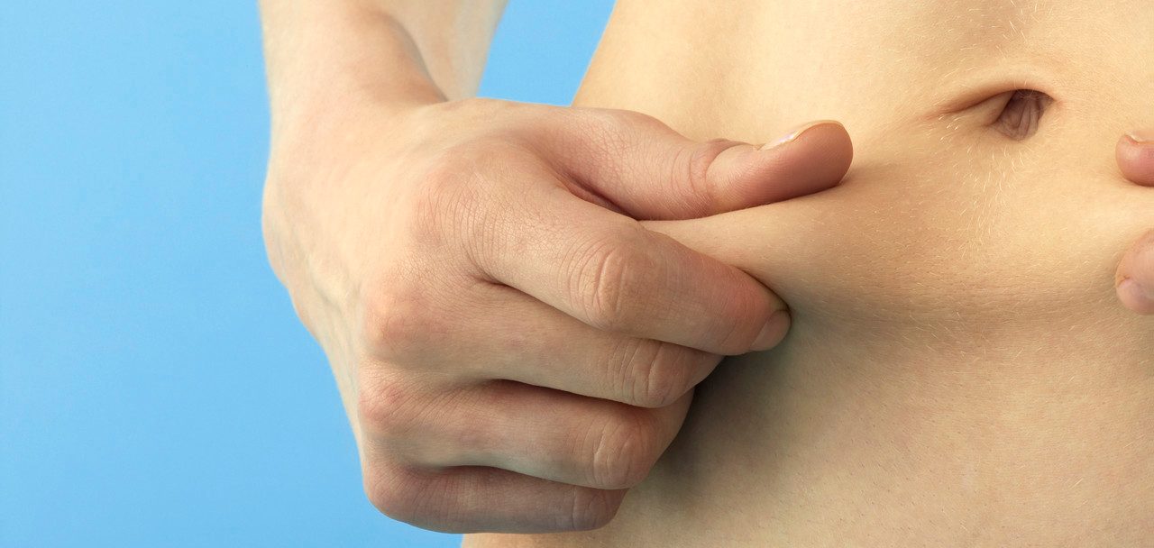 Young Woman Holding Skin on Stomach --- Image by © Corbis