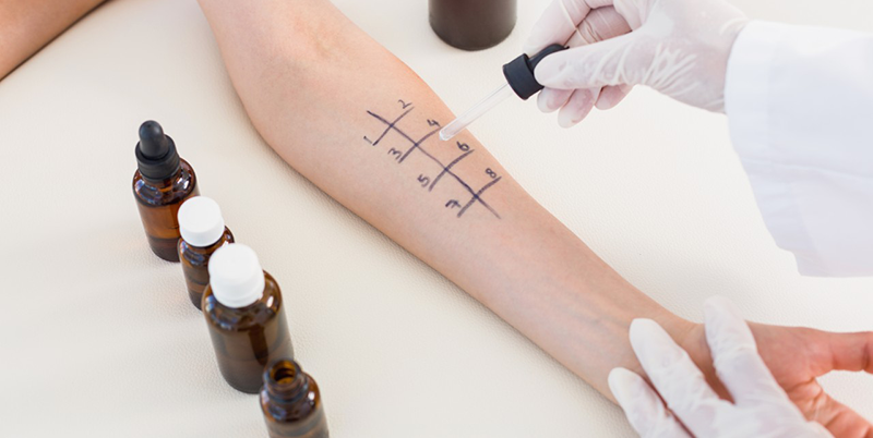 29 Jan 2015 --- Doctor doing skin prick test at her patient --- Image by © Wavebreakmedia LTD/Wavebreak Media Ltd./Corbis