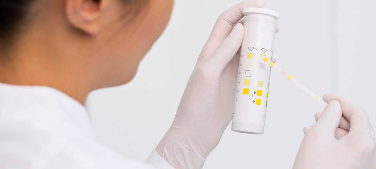 Female scientist testing urine sample --- Image by © Judith Haeusler/Corbis