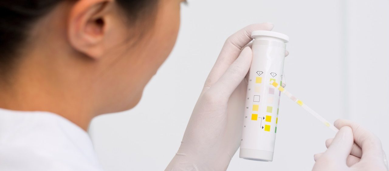 Female scientist testing urine sample --- Image by © Judith Haeusler/Corbis