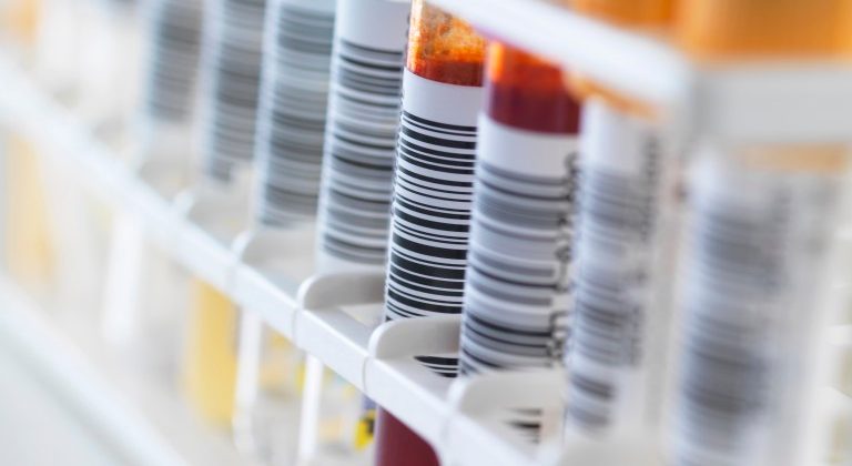 23 Jan 2014 --- A row of human samples for analytical testing including blood, urine, chemistry, proteins, anticoagulants and HIV --- Image by © Rafe Swan/Corbis